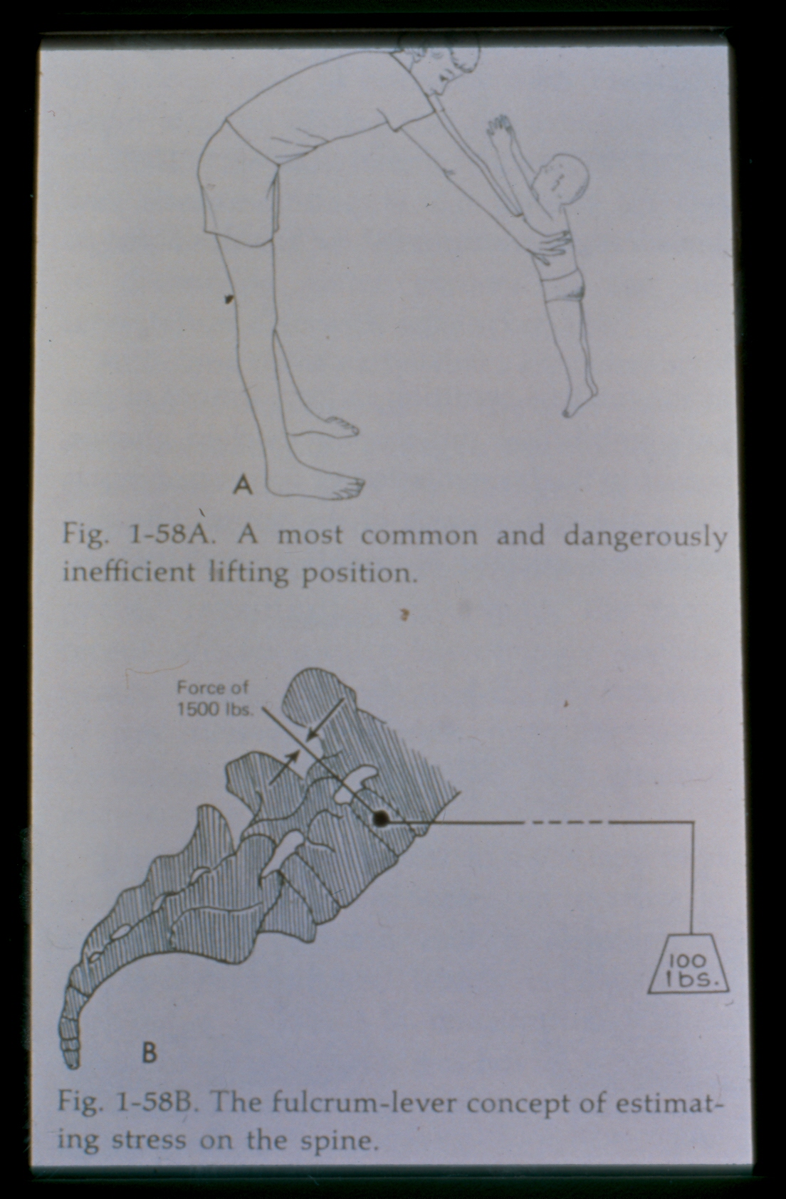 Pressure On Low Back When Lifting